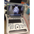 MSLCU18K Digital color doppler 3d 4d cheap ultrasound machine of electronic wholesale